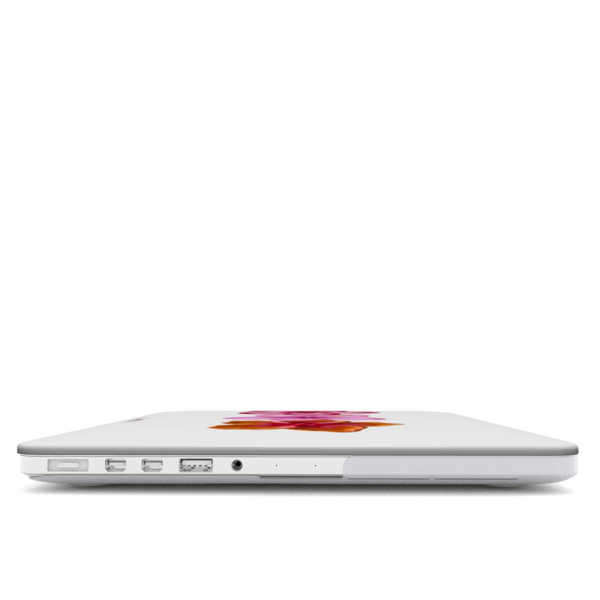 hibiscus macbook case